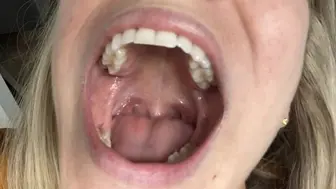 Free Tiny On Teeth Porn Videos Pornmeka