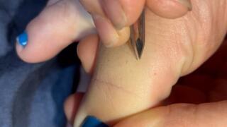 Say goodbye to my toe hairs