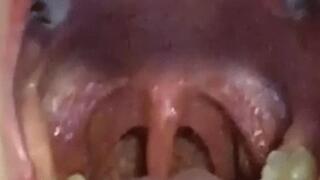3 CLIPS OF OPEN MOUTH YAWNING