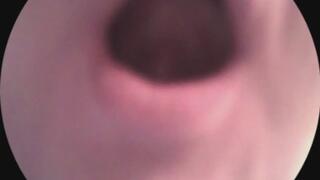 endoscope- mouth tour