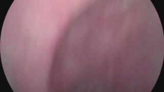 endoscope-mouth tour 2
