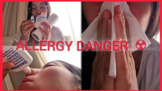 ALLERGY DANGER