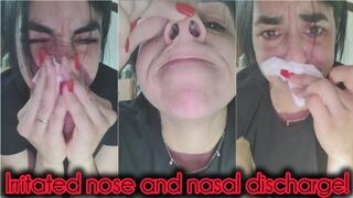 Irritated nose and nasal discharge!