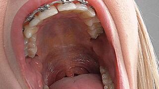 Big mouth gaping! MP4