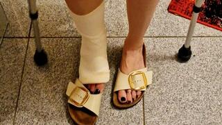 German Housewife in Cast and crutches with Birkenstocks and barefoot