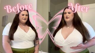 Breast Expansion | When a Boob Job Goes Too Far