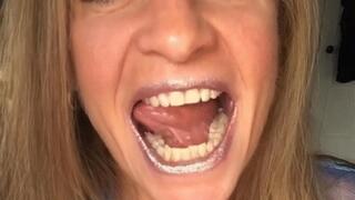 SILVER AND GOLD LIPS