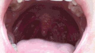 ORAL CAVIT CLOSE UP TO THE CAMERA 4