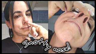 Snotty nose!