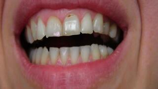 teeth pretend to eat you