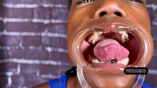 Super sleepy dental retractor mouth tour mouth sounds