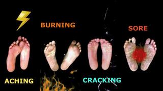 Life with Athlete's Foot IV - Parody on Desenex Family of Feet and more