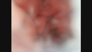 Bailey's Lost Endoscope Footage