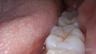 Macro ASMR endoscope mouth tour 2