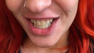 Mouth tour 2 - Rotten teeth, yellow tongue while smoking