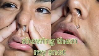 Showing all my snot