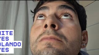 White eyes, rolling eyes