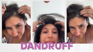 Dandruff Close-Up – Pure Visual Fetish