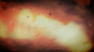 A Journey Through Digestion: A Fascinating Exploration with the Capsule Endoscope 4k