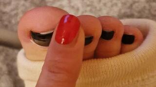 sweet toes in cast and how she frees the foot