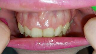 beautiful teeth tour