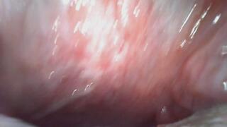 Katja Endoscopic Mouth Tour 2