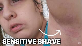 Irritated Armpit Gets Shaved Anyway