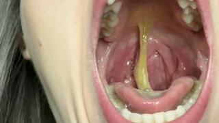 Rotten phlegm, I create food for you HD