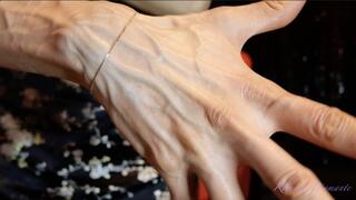The large and numerous veins in my hands, even moving like a snake!
