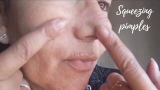 Squeezing pimples