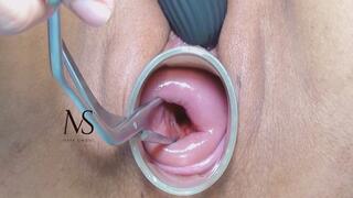 MASTURBATION OF MY OPEN-MOUTHED CERVIX 4k
