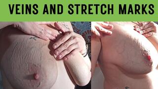 Veiny and stretch mark breasts