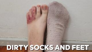 Taking Off My Dirty Socks to Show My Toes