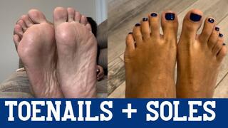 Toenails + Soles