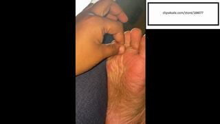 Delicious Athletes foot inspection pov