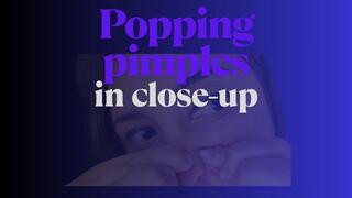 Popping my pimples in close-up