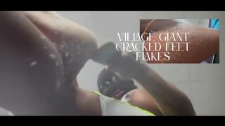 Village Giant Cracked Feet Flakes Rain On Tinnies