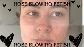 A whole day blowing my nose