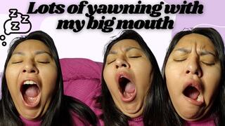 Lots of yawning with my big mouth