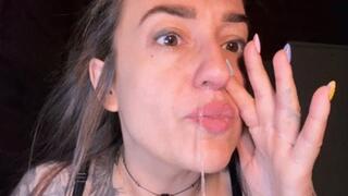 covid has destroyed me, Tonsils stones HD