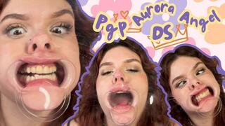 Plexiglass Princess With Aurora Angel Dental Apparatus