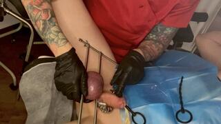 Medical CBT - Double urethral stretching and ball crushing