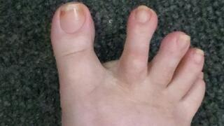 Longing for long toe wiggles with mixed in cracks?