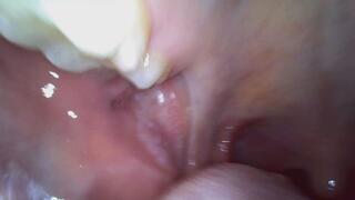 Vicky's Endoscopic Mouth Tour