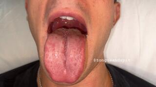 Louis Hillcrest Mouth and Tongue Part9 Video1 - MP4