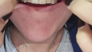 Examining my teeth and mouth!