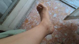 PAINFUL BLISTERS AND DIRTY SOLES