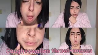 Cough+swollen throat+mucus!