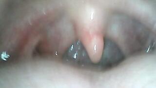 Baileys Endoscopic Journey