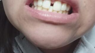 Admire my imperfect teeth - fetish